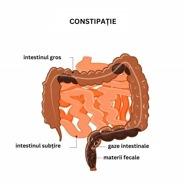 Schema constipației