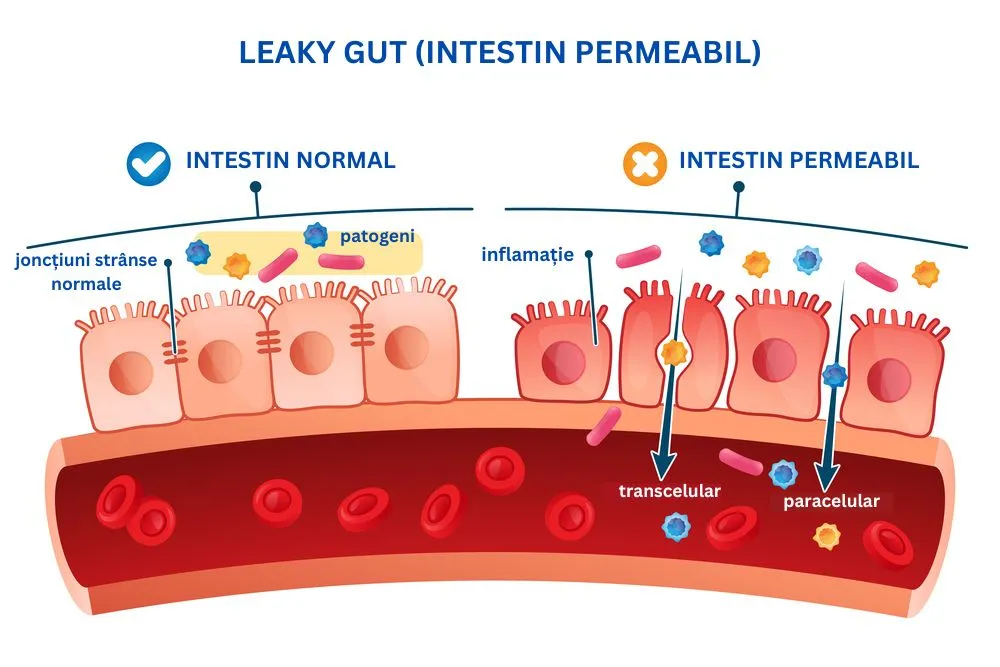 schema leaky gut explicată