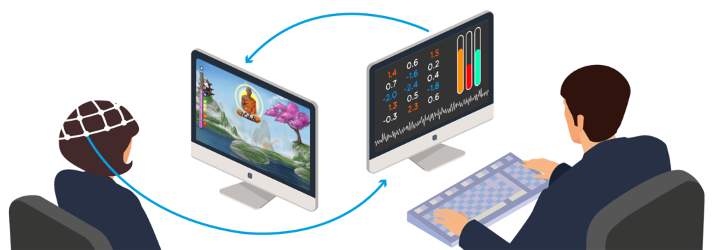 neurofeedback 