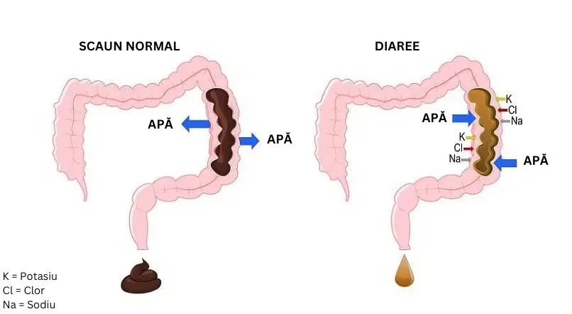 Schema grafică a diareei